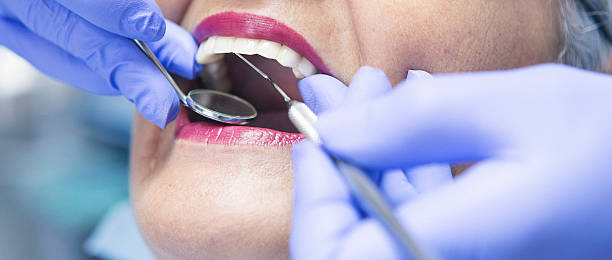 Best Emergency Dental Care for Broken or Chipped Teeth in Dyer, IN